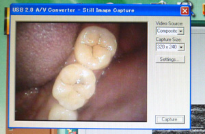 治療内容のわかりやすい説明